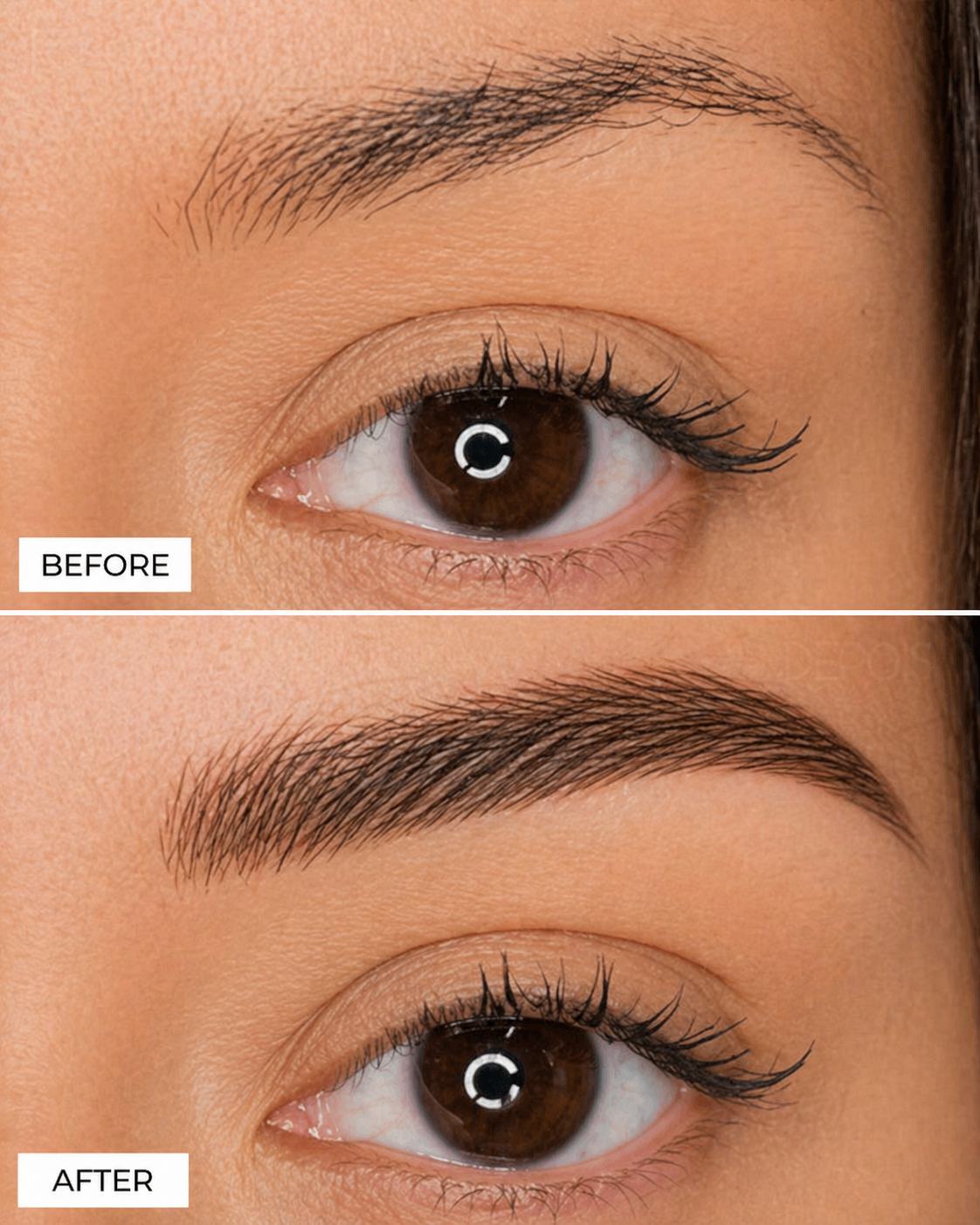 ReGrow Medical — Close-Up Brow Detail