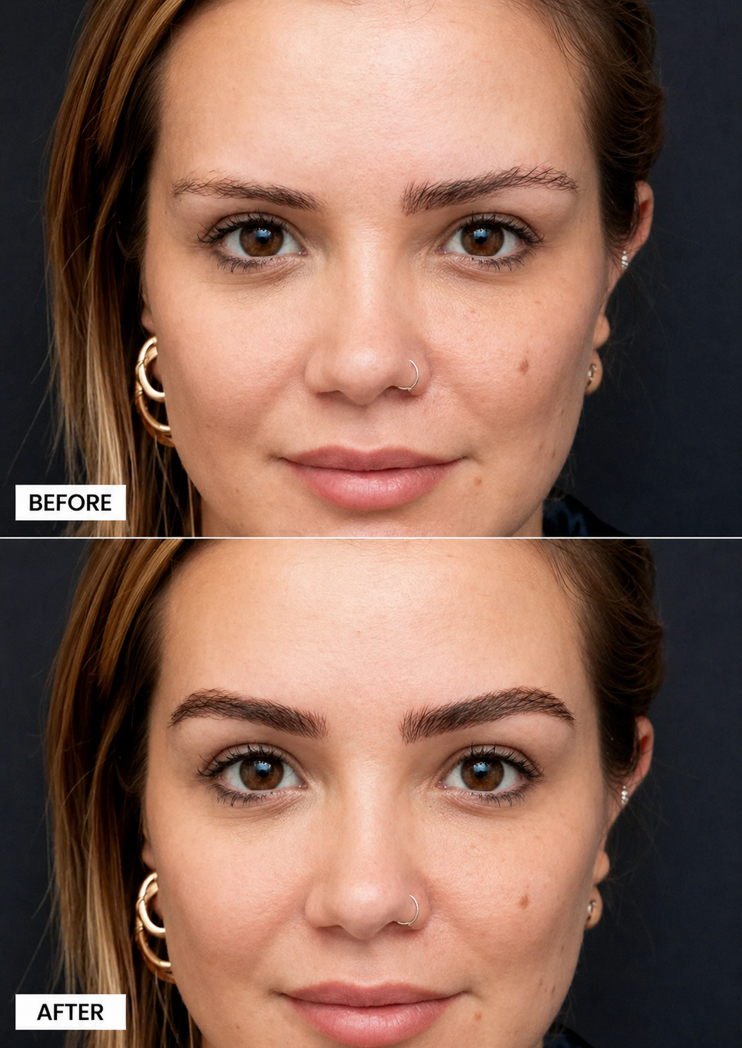 ReGrow Medical — Full Brow Redesign