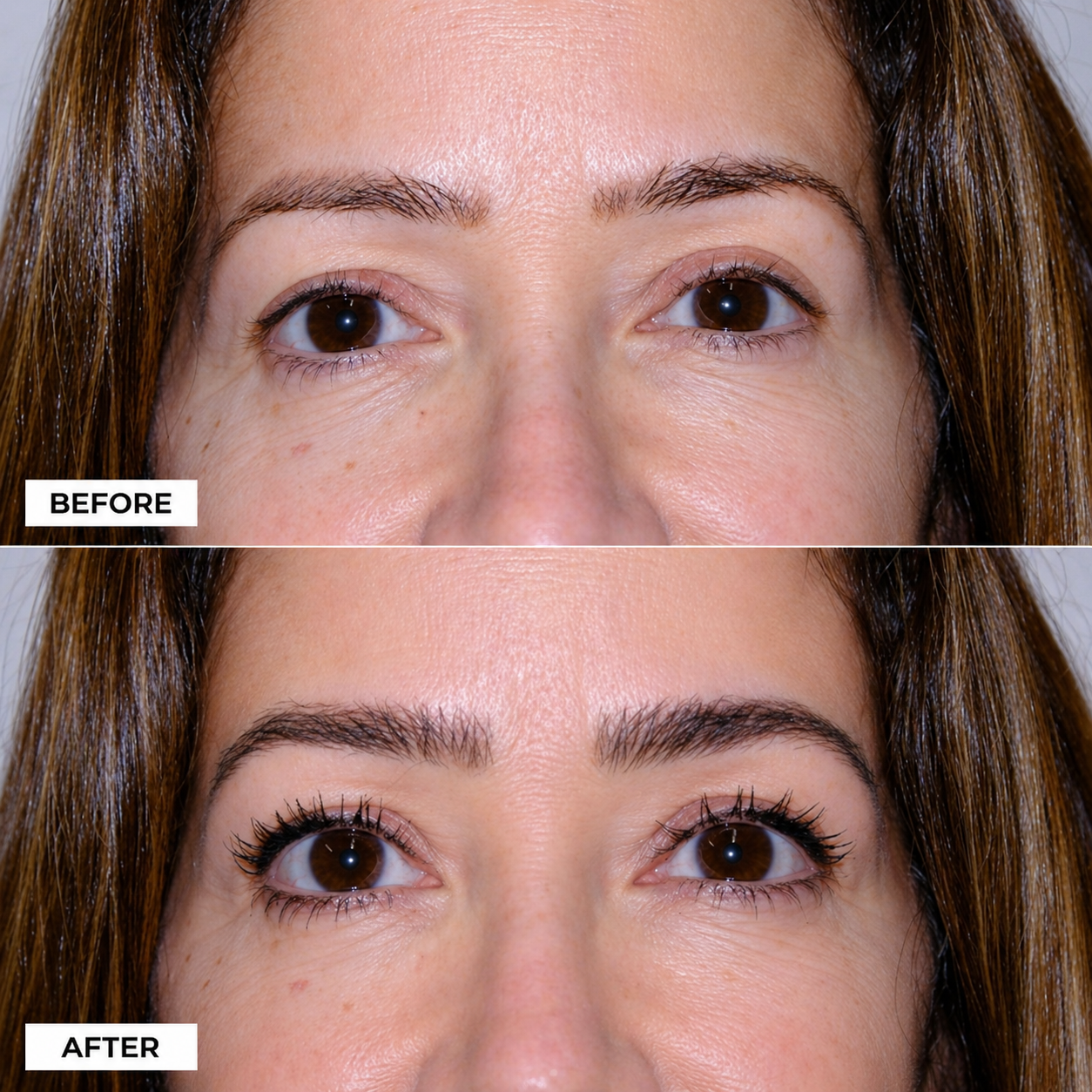 ReGrow Medical — Mature Brow Restoration