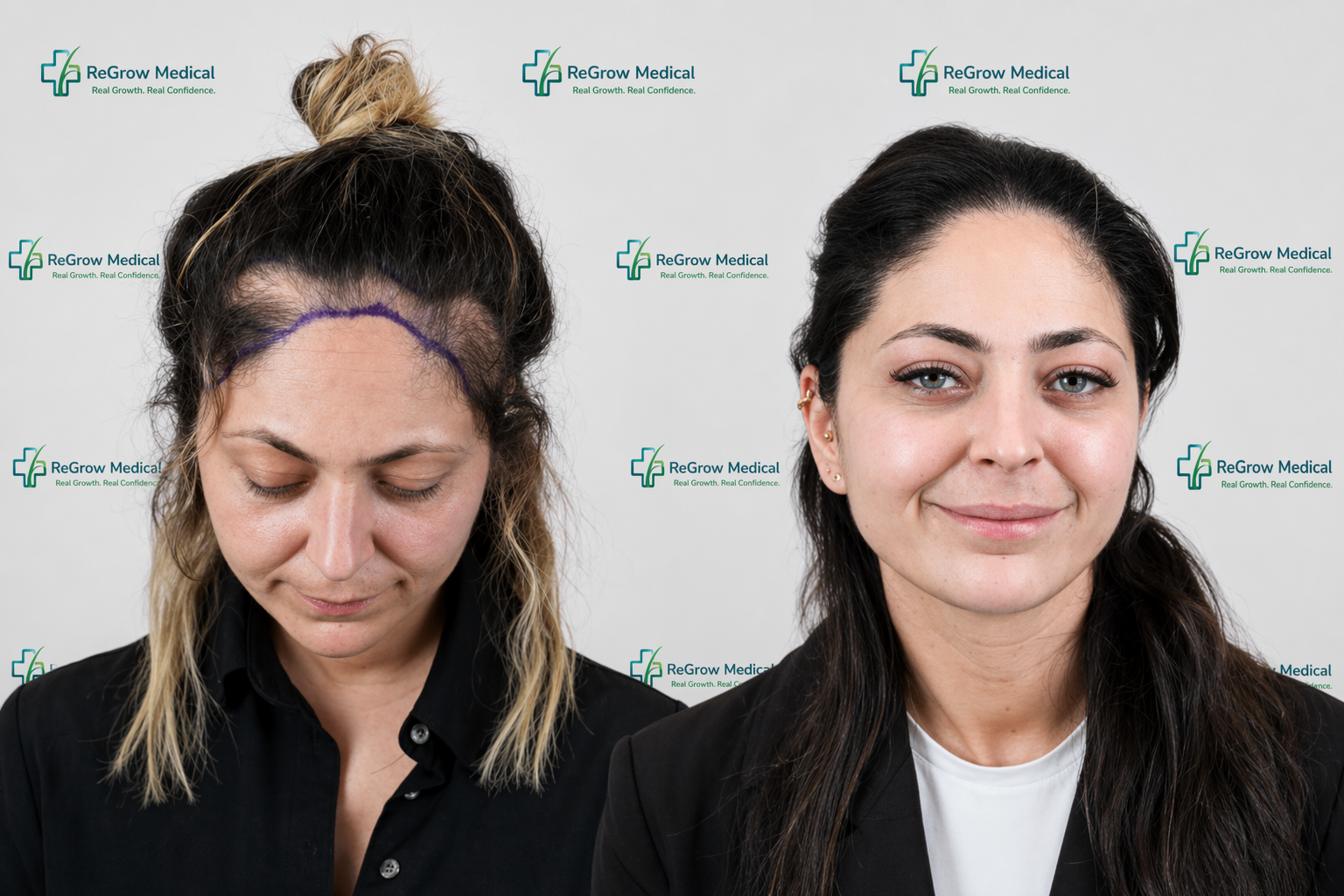 ReGrow Medical — Full Transformation